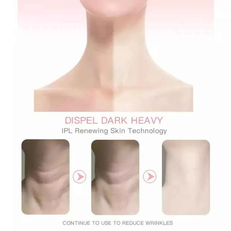 EMS Neck Face Lifter Neck Face Lifting Massager Skin Tighten Device Led Photon Therapy Anti Wrinkle Double Chin Remover