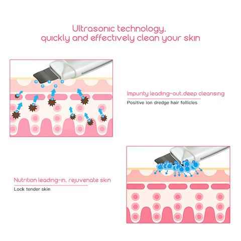 Ultrasonic Skin Scrubber Face Cleanser | Blackhead Remover Machine