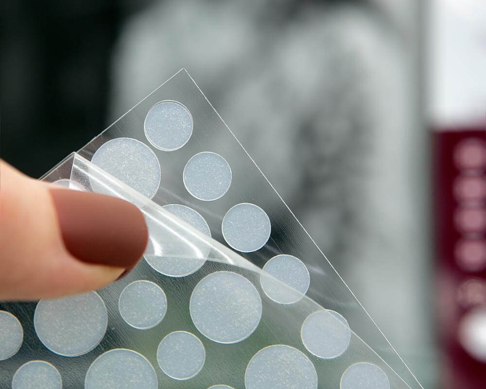 Acne Treatment Stickers For Deep Pimples | Invisible Acne Patches