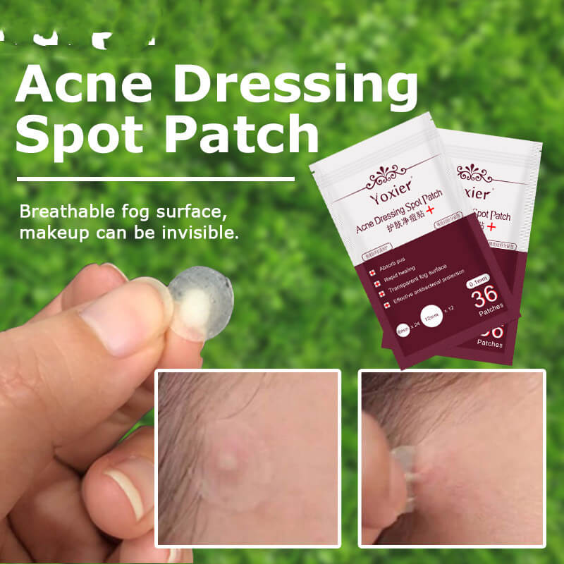 Acne Treatment Stickers For Deep Pimples | Invisible Acne Patches