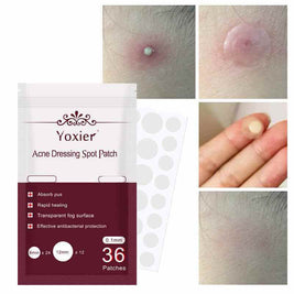 Acne Treatment Stickers For Deep Pimples | Invisible Acne Patches