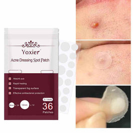 Acne Treatment Stickers For Deep Pimples | Invisible Acne Patches