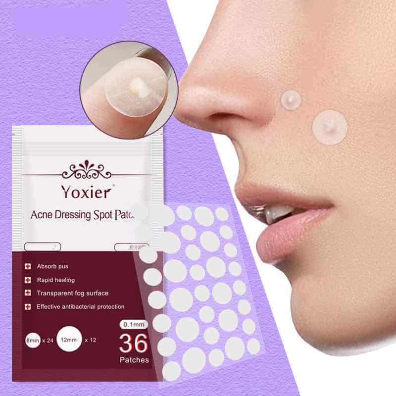 Acne Treatment Stickers For Deep Pimples | Invisible Acne Patches
