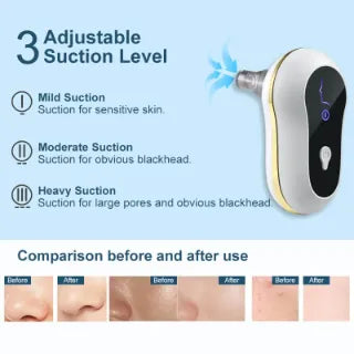 Electric Blackhead Remover For Face | Suction Pore Cleanser