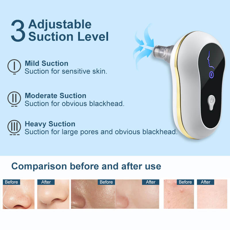 Electric Pedicure File For Feet | Portable Rechargeable Foot File