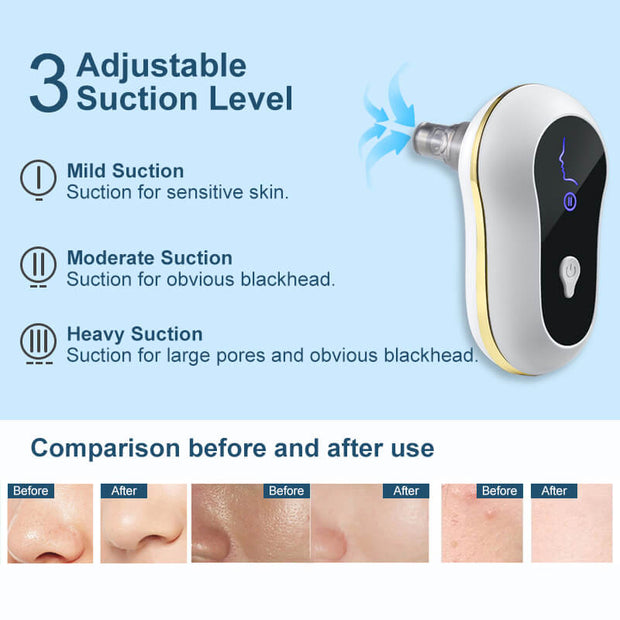 Electric Pedicure File For Feet | Portable Rechargeable Foot File