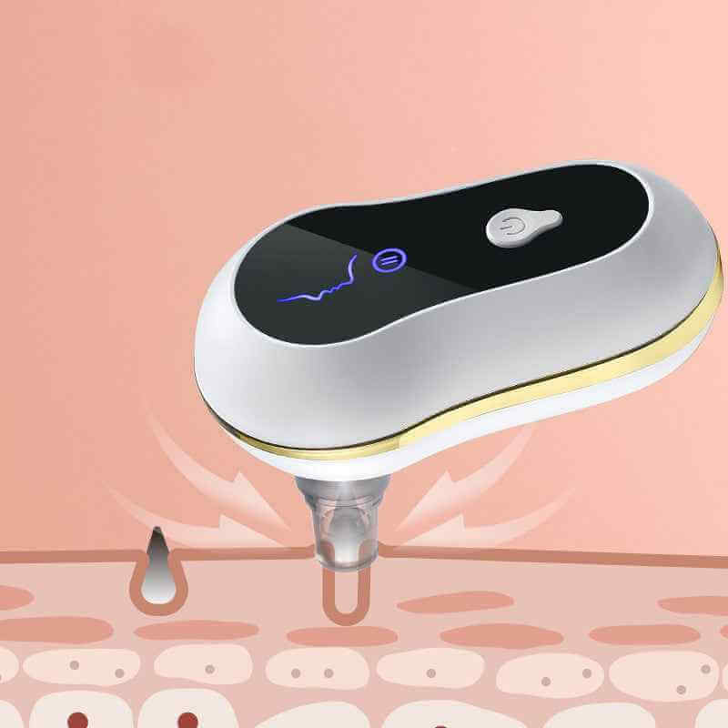 Electric Pedicure File For Feet | Portable Rechargeable Foot File