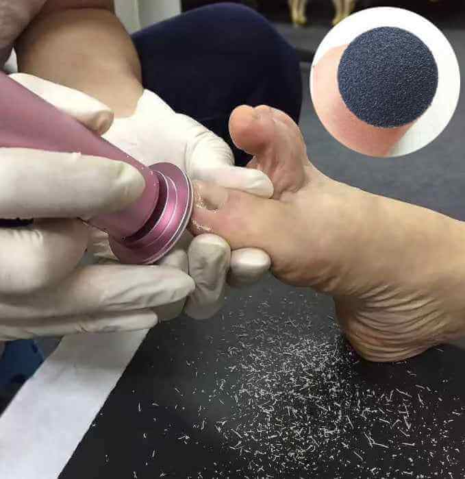 Electric Pedicure File For Feet | Portable Rechargeable Foot File