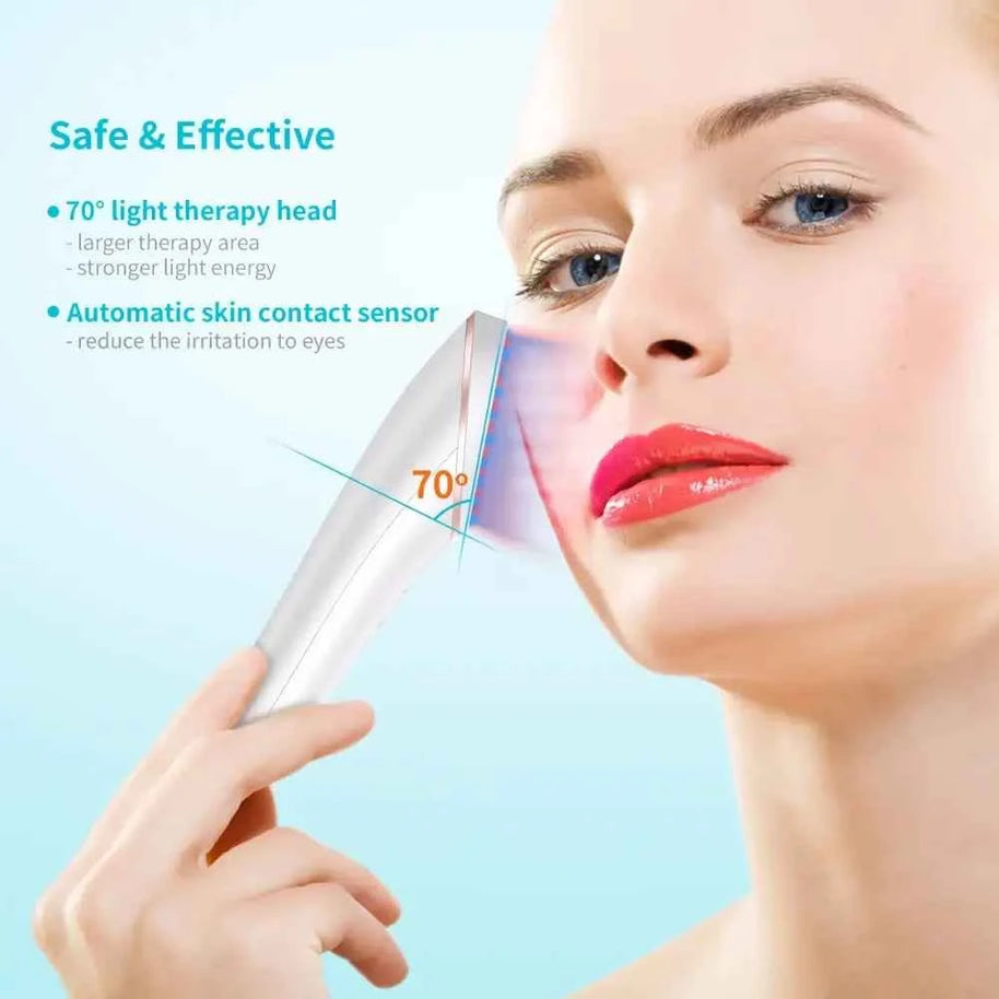 Red And Blue Light X-Preen Therapy | LED Acne Clearing Eraser Device