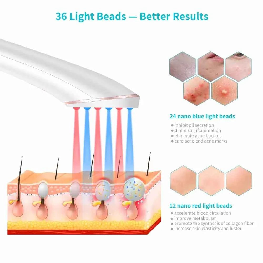Red And Blue Light X-Preen Therapy | LED Acne Clearing Eraser Device