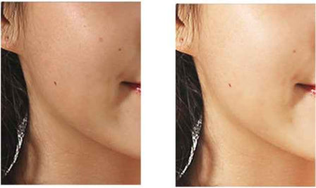 Rotating Pore Cleansing Brush | Rechargeable Face Wash Brush