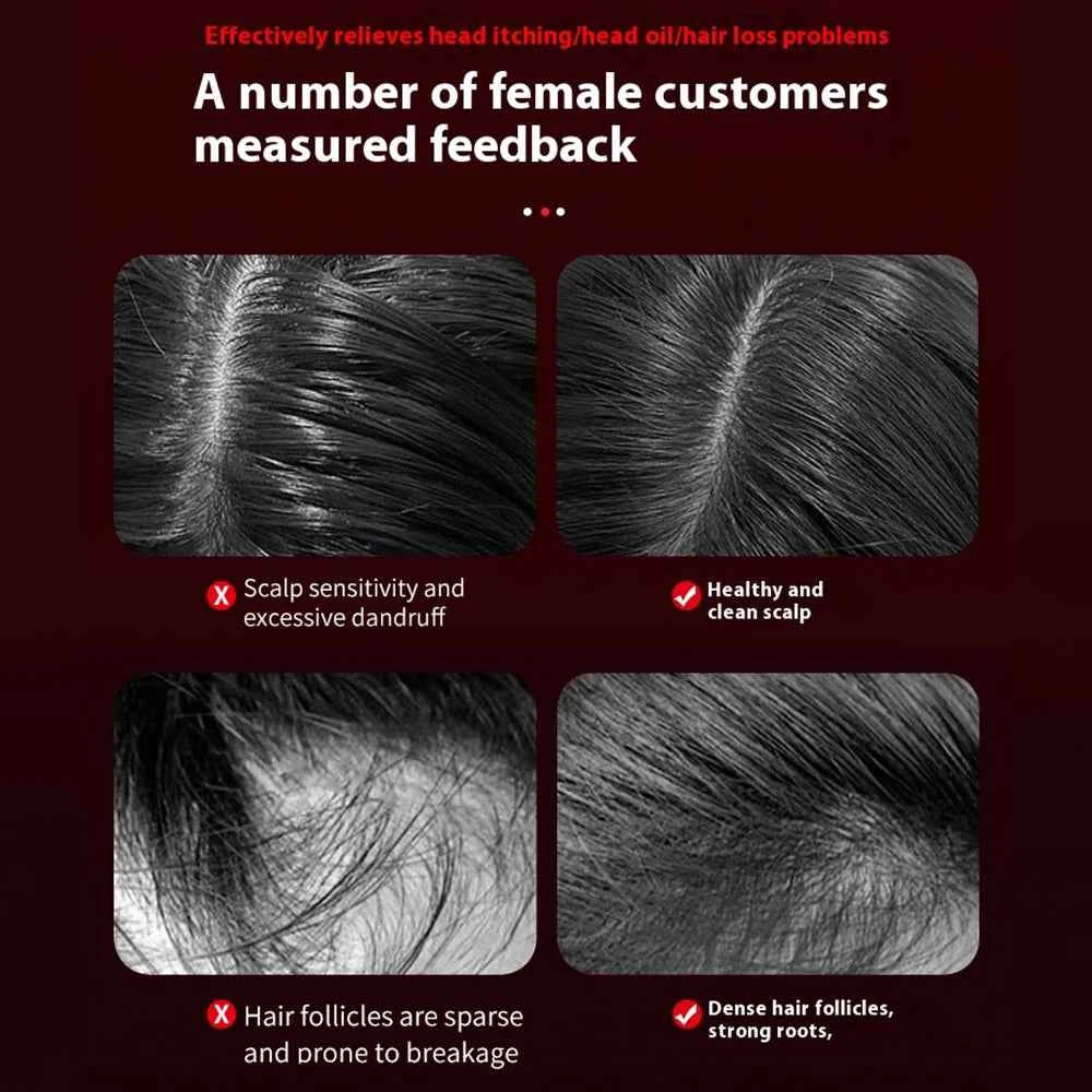 3 Modes Electric Vibration Massage Comb Red Light Therapy Hair Growth Massage Scalp Brush Oil Liquid Applicator Head Massager