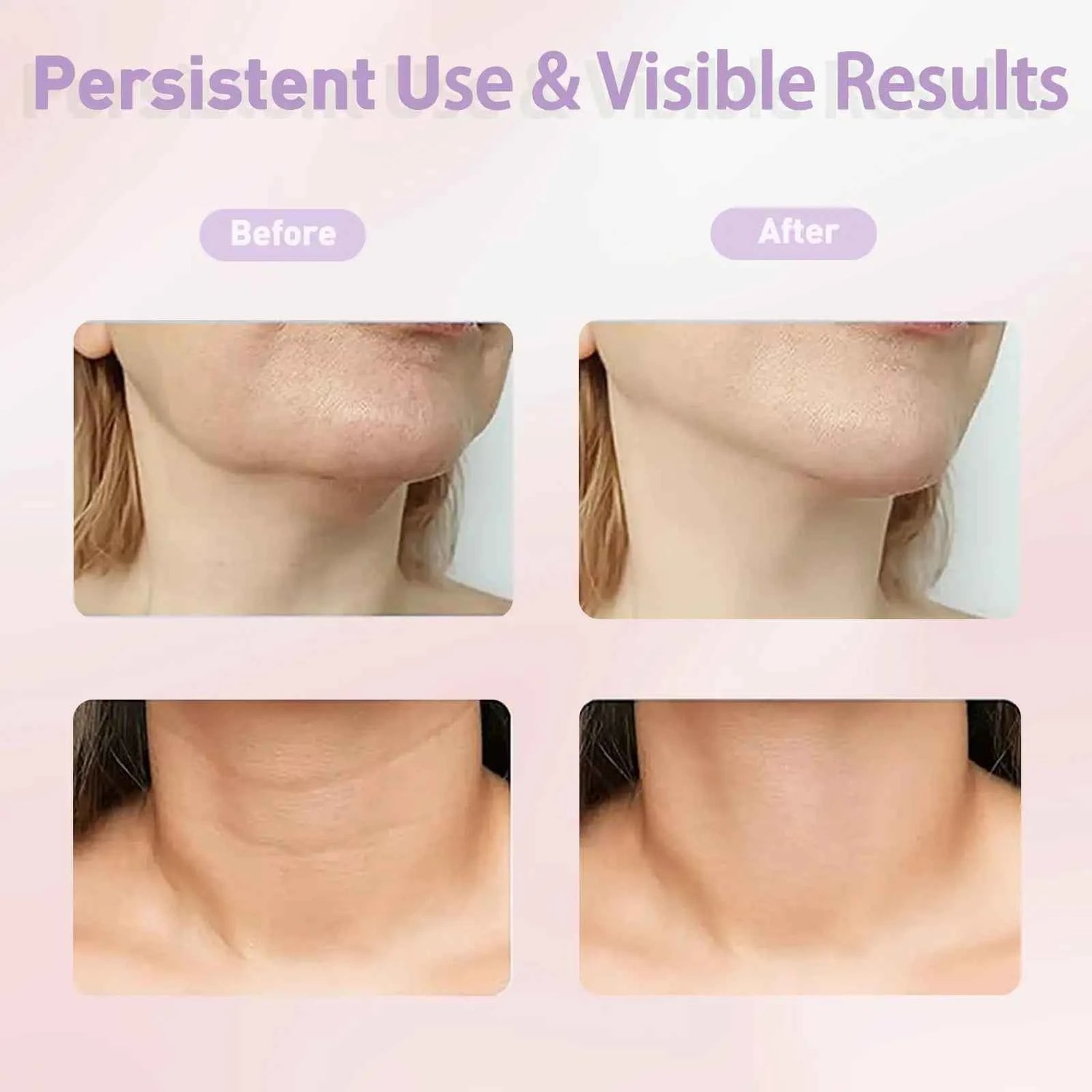 EMS Neck Face Lifter Neck Face Lifting Massager Skin Tighten Device Led Photon Therapy Anti Wrinkle Double Chin Remover