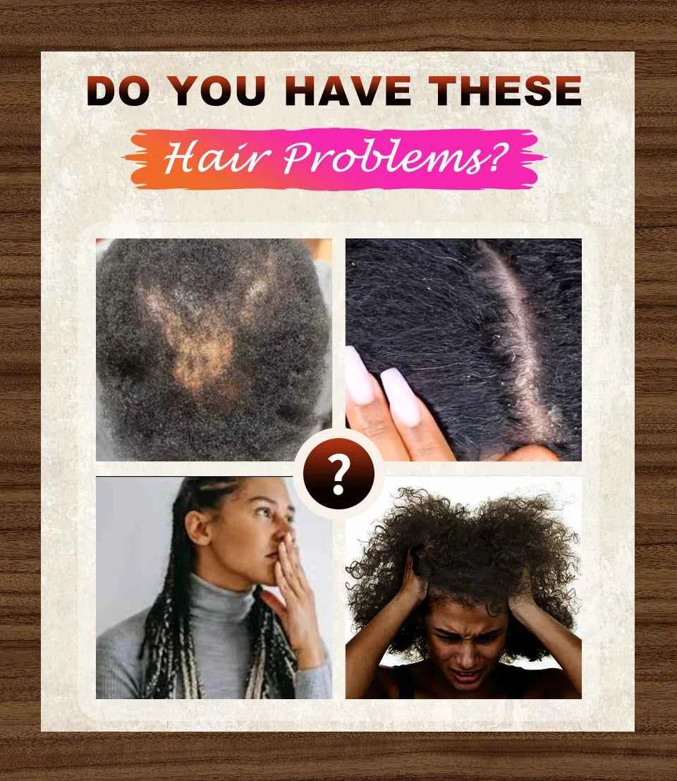 Fast Hair Growth Oil African Crazy Chebe Hair Oil Traction Alopecia Treatment Oil Natural Crazy Hair Regrowth Anti Hair Care