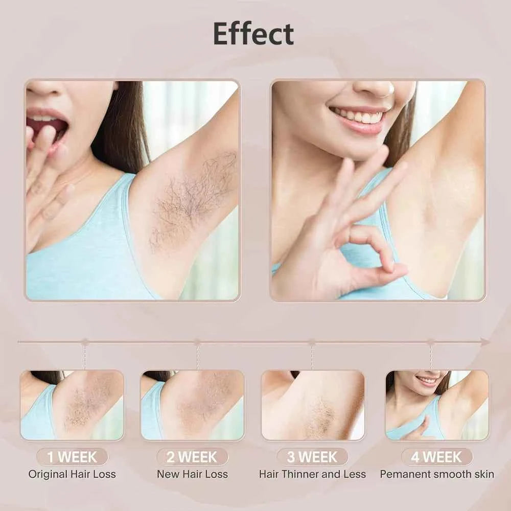 HOMEFISH Laser Epilator IPL Hair Removal For Women Body Bikini Facial 990000 Flashes Permanant Painless IPL Hair Remover Laser